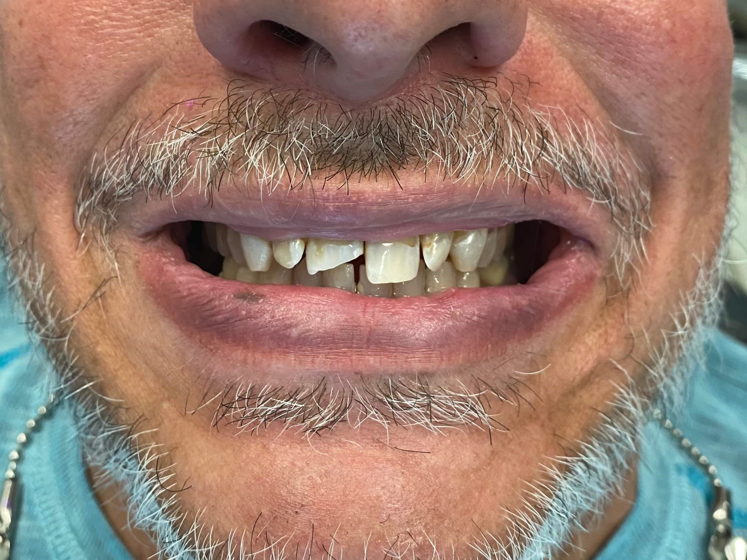 Before Image
