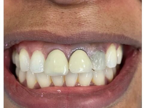 Before Image