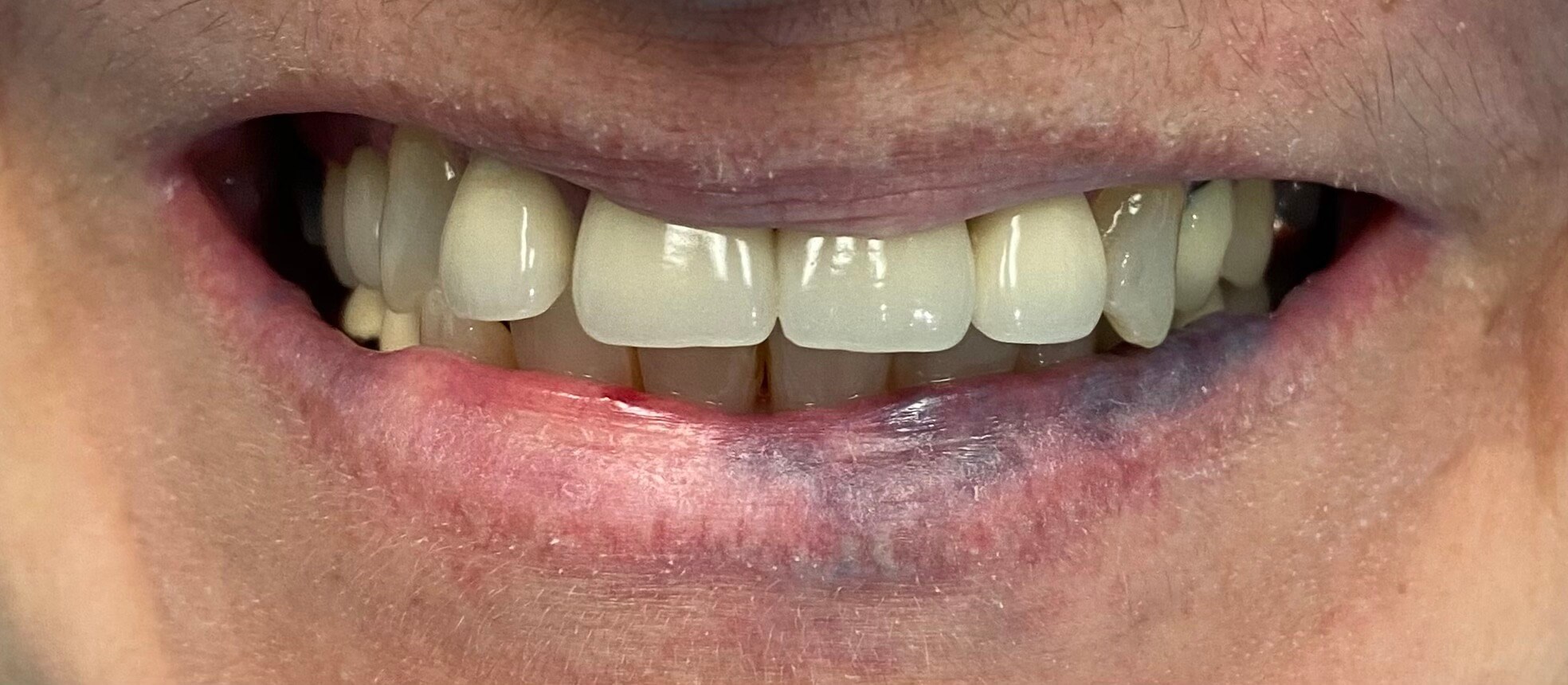 Before Image