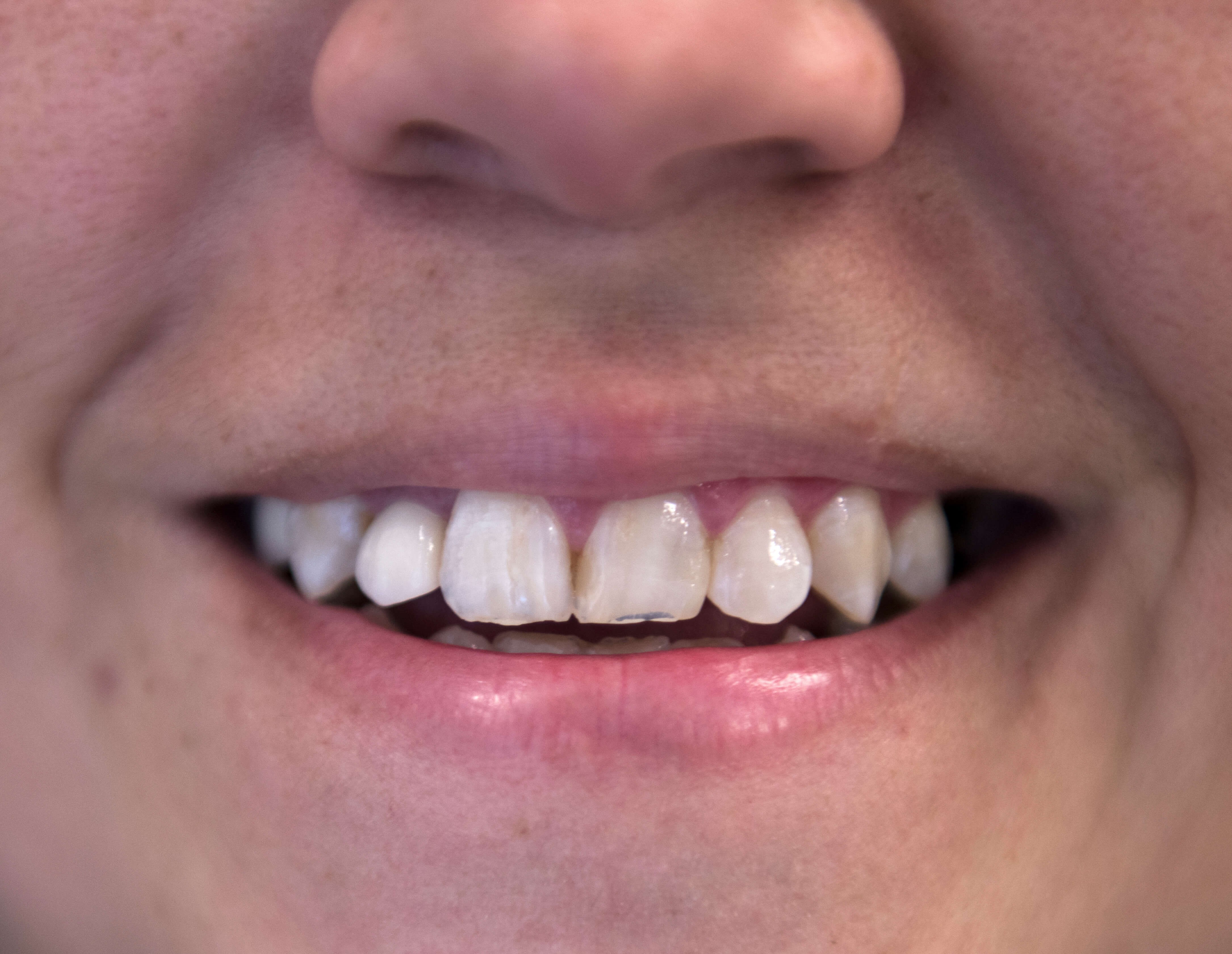 Before Image