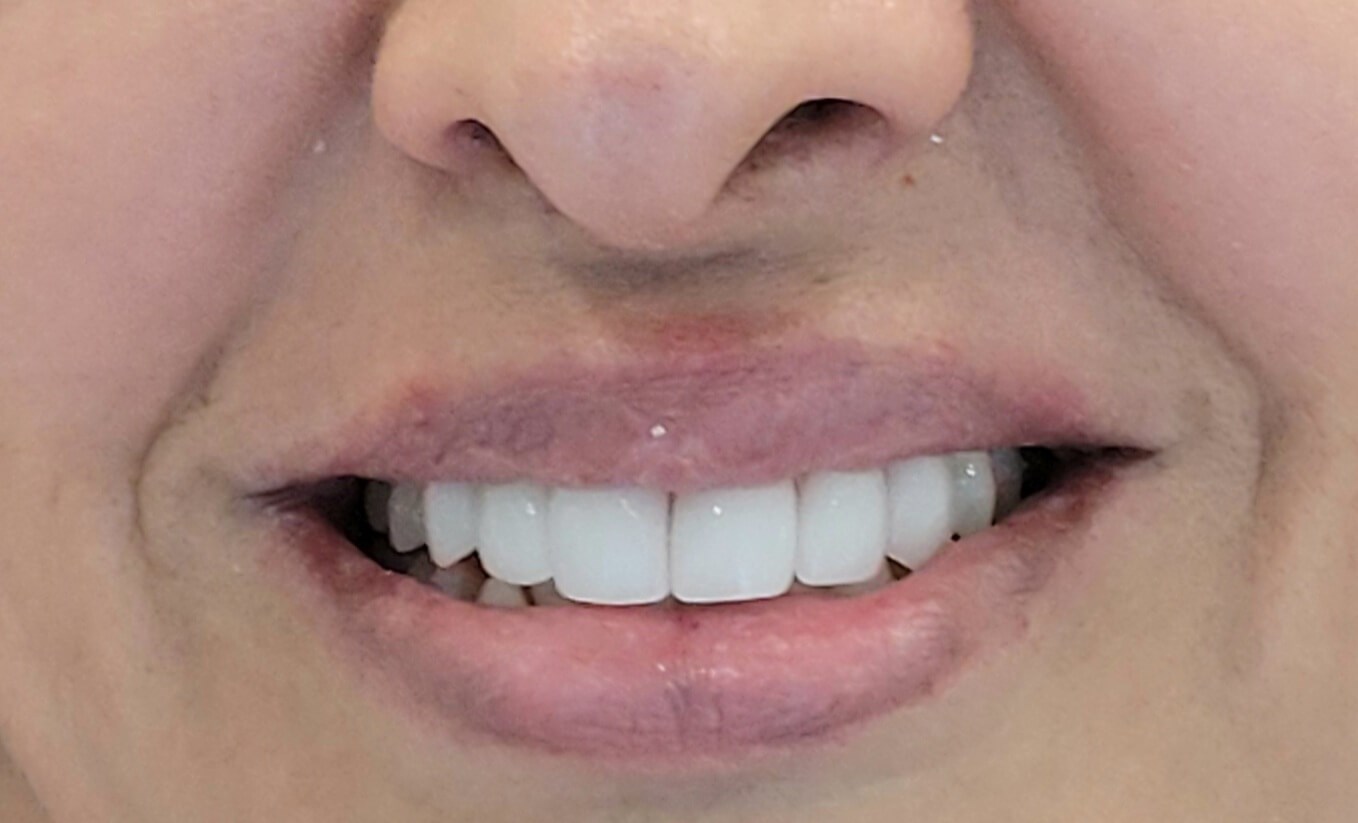 After Image