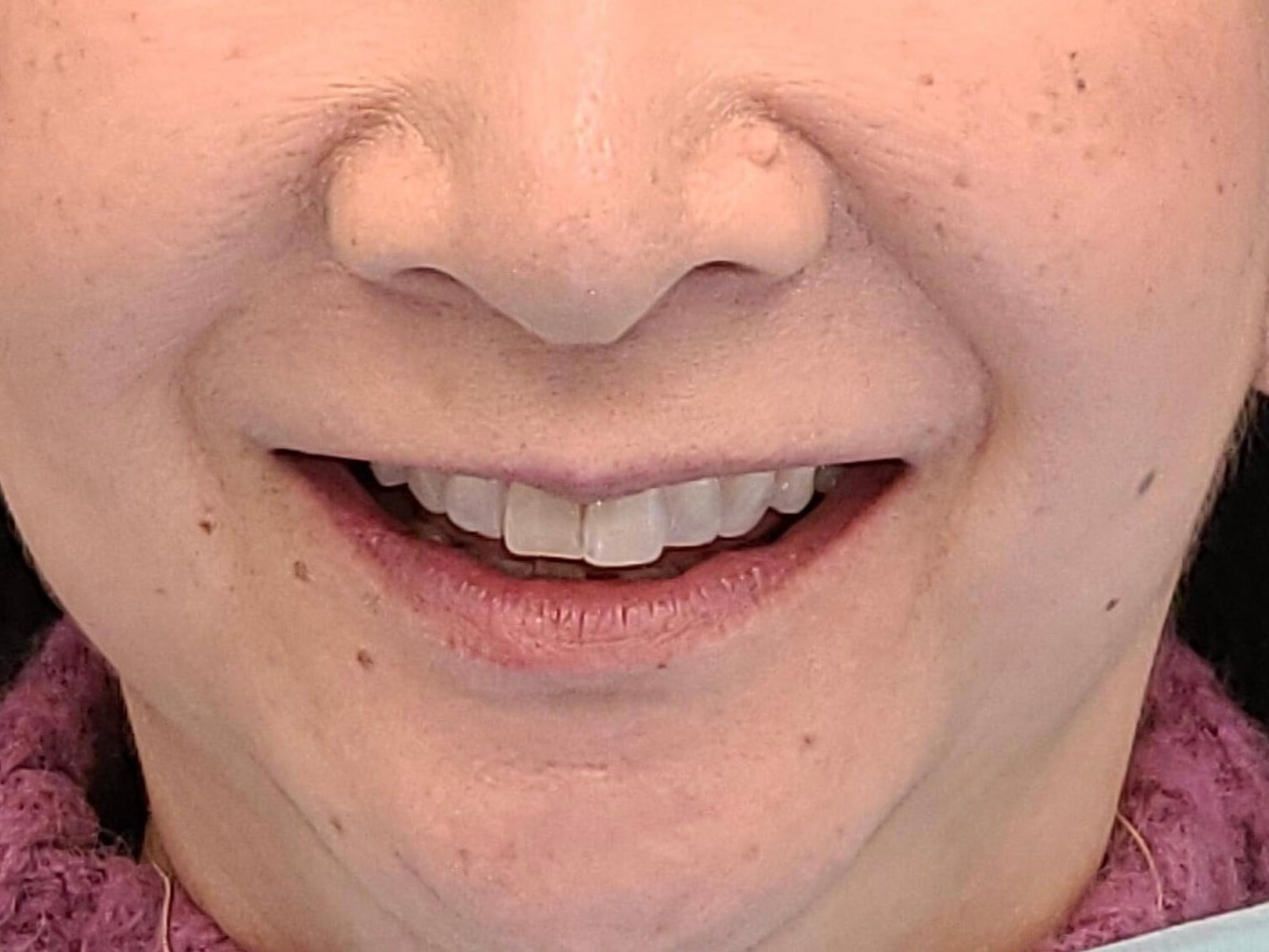 Cosmetic Dentistry Before