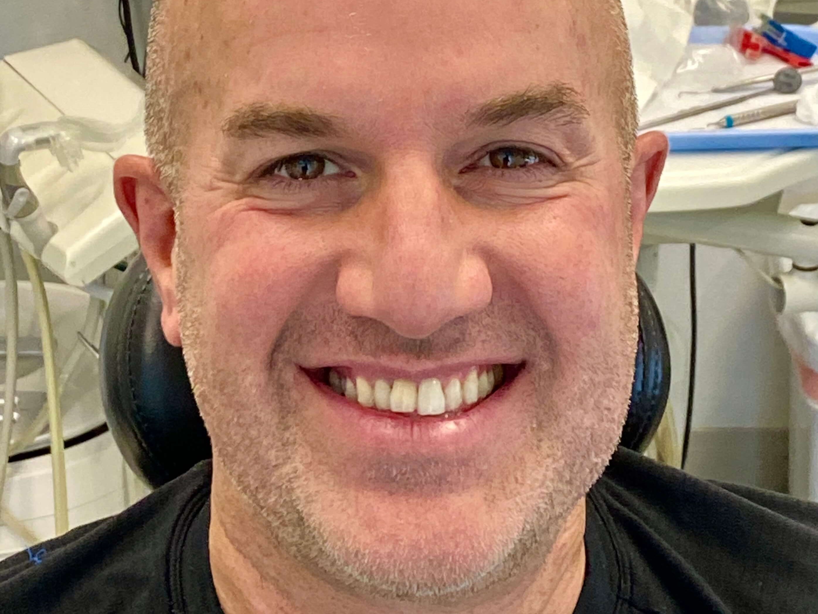 Cosmetic Dentistry Before