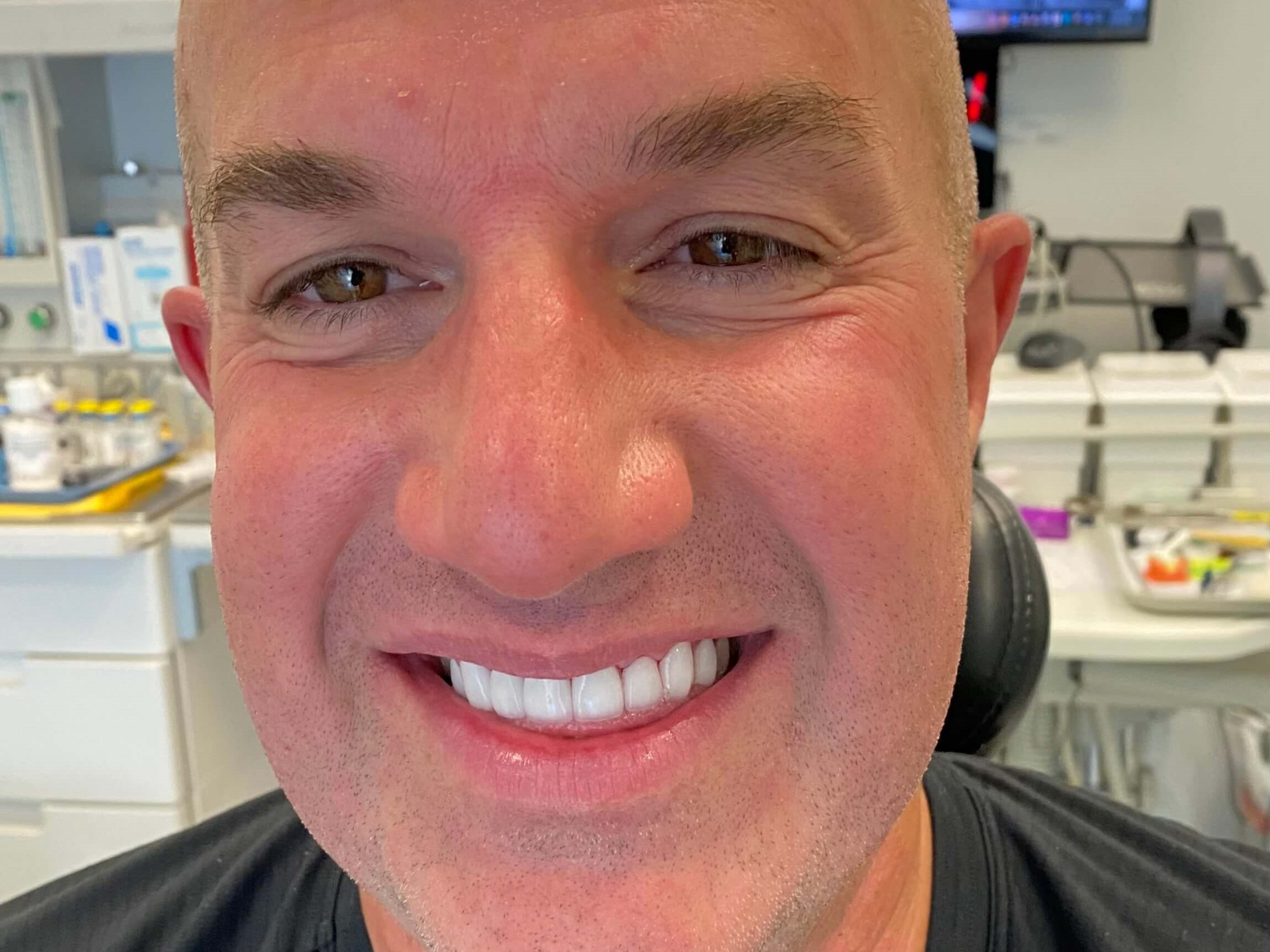 Cosmetic Dentistry After