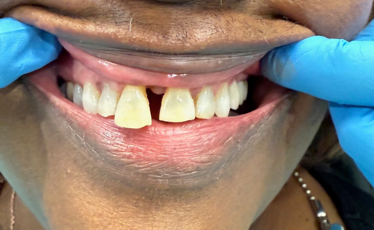 Cosmetic Dentistry Before