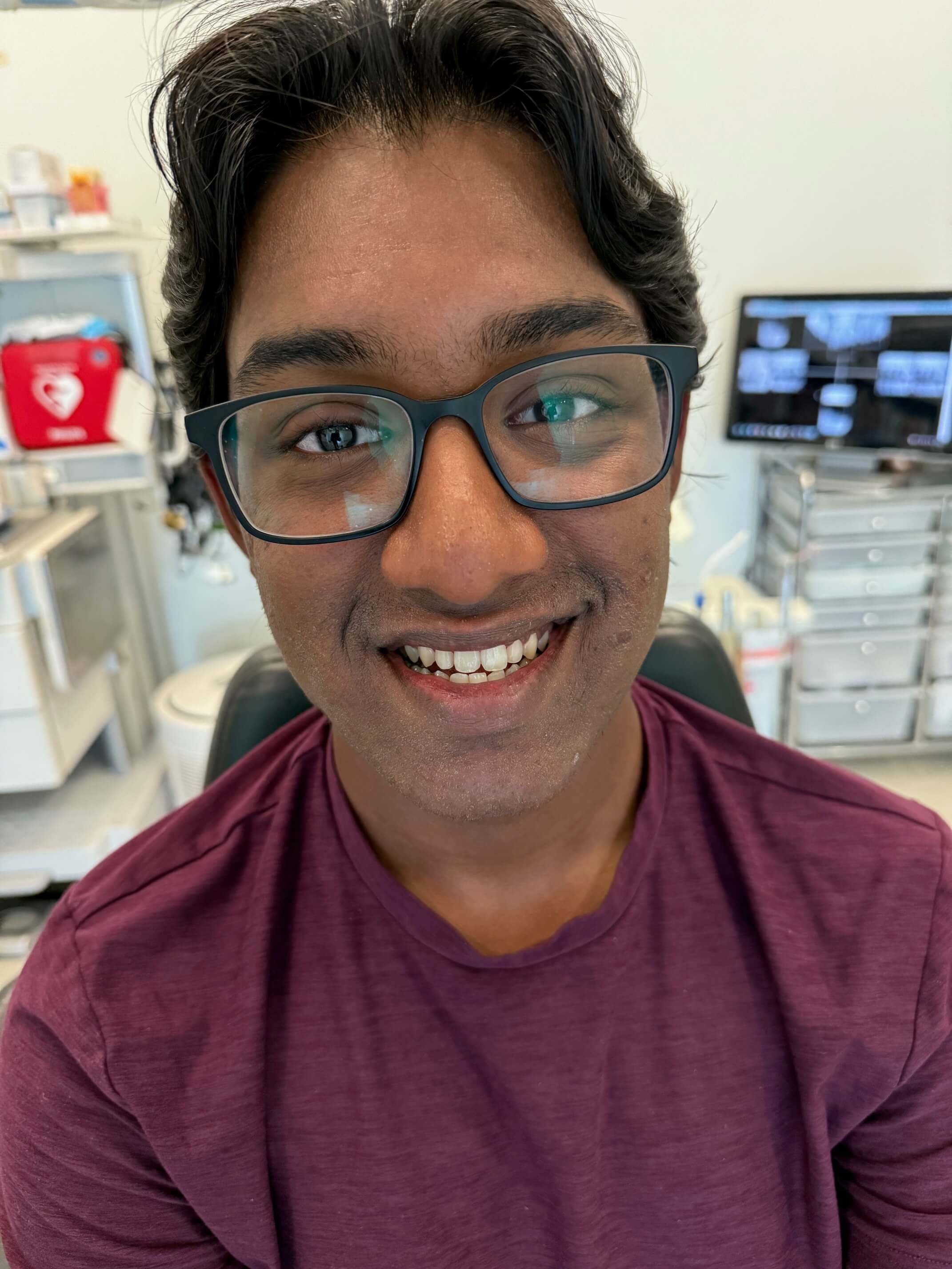 Invisalign® Transformation After