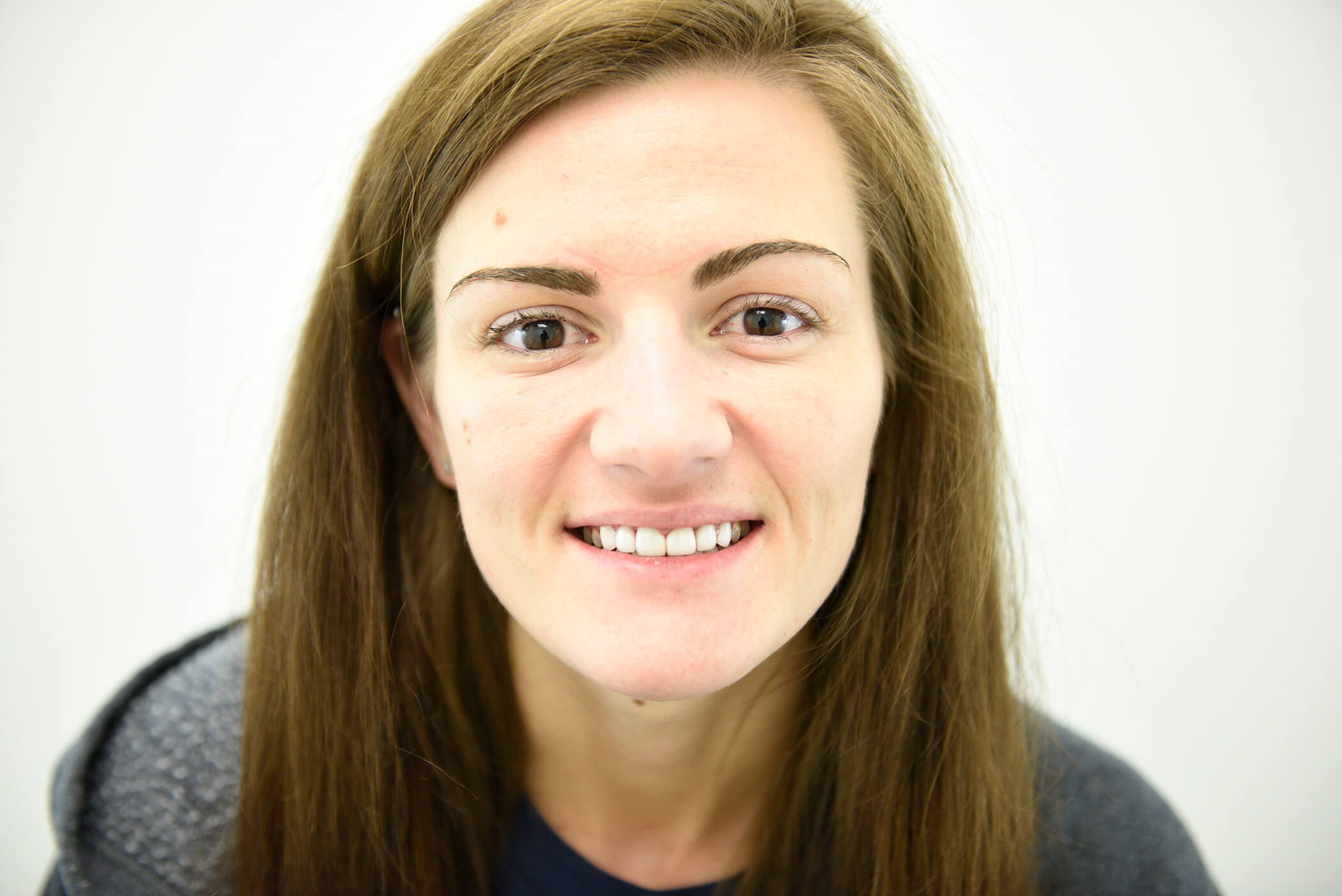 Brand New Smile After