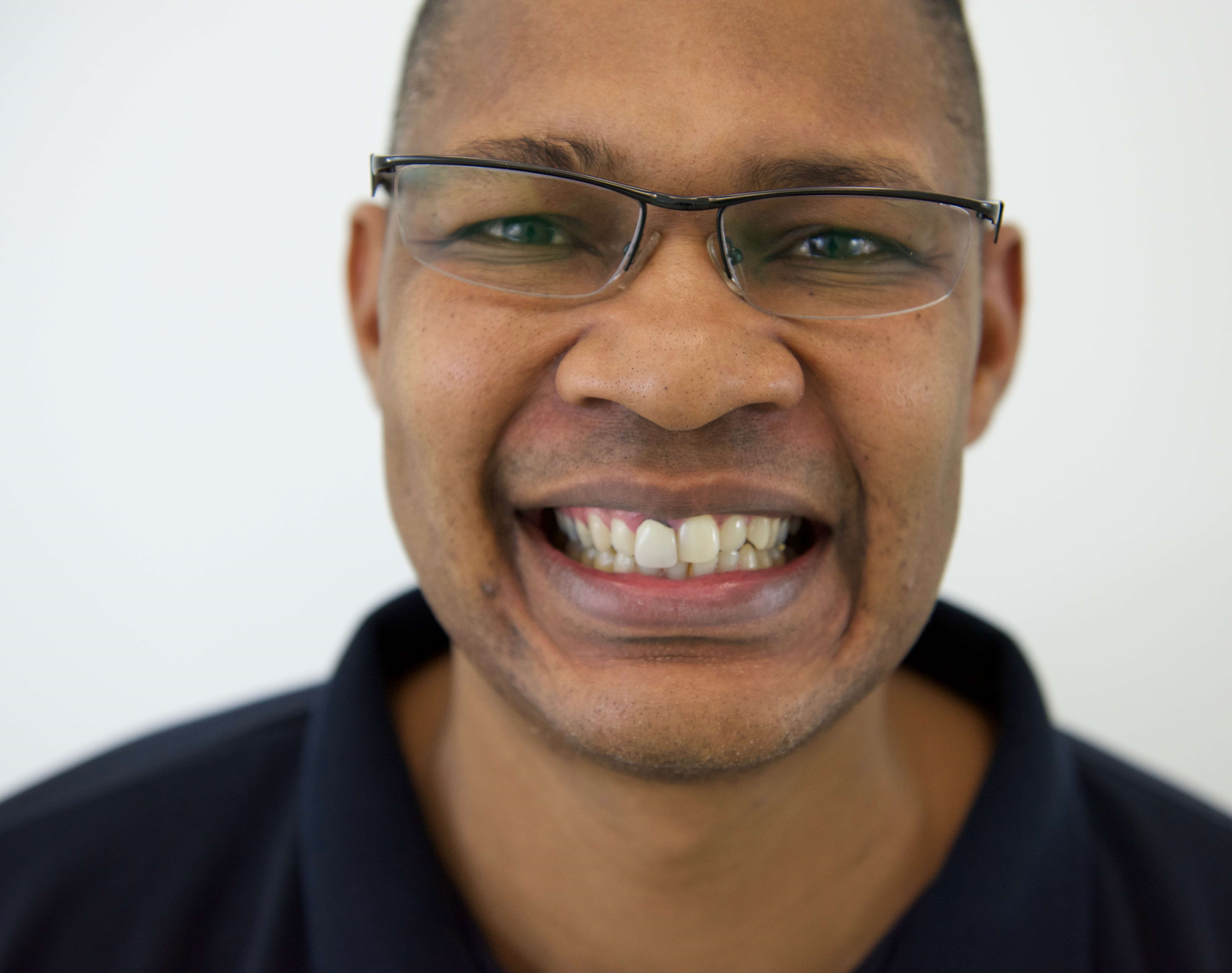 New Smile New You Before