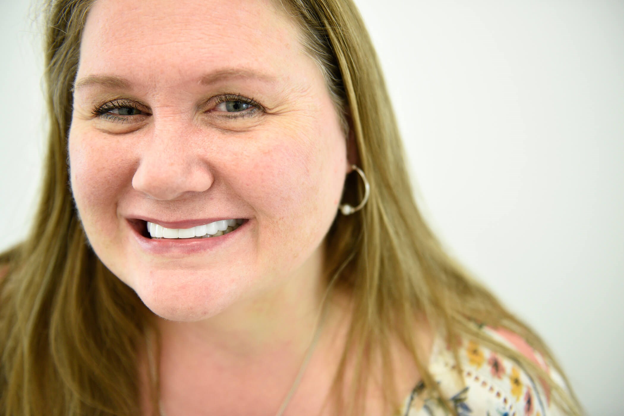 New Smile Design After