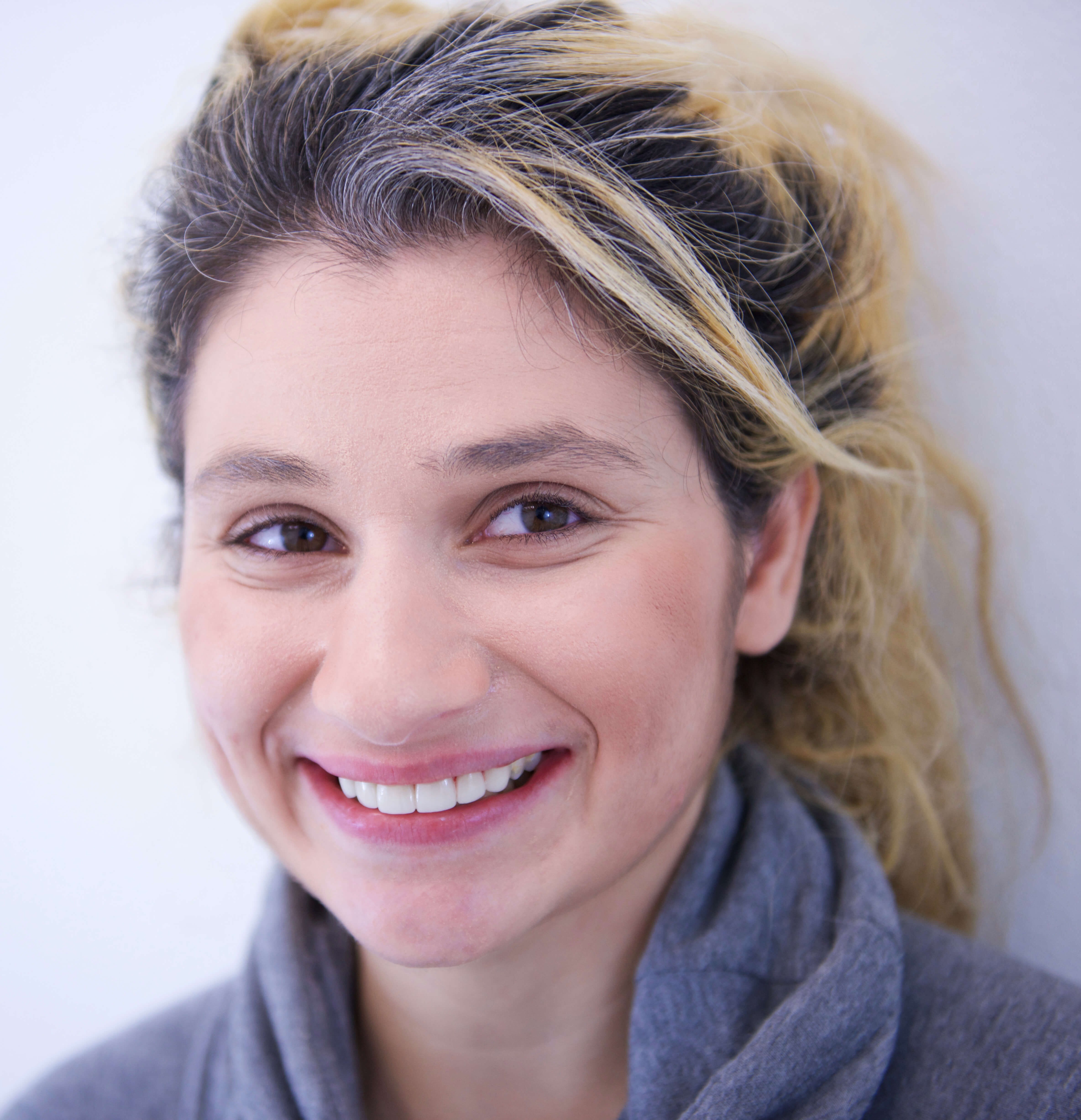 Full Mouth Rehabilitation After