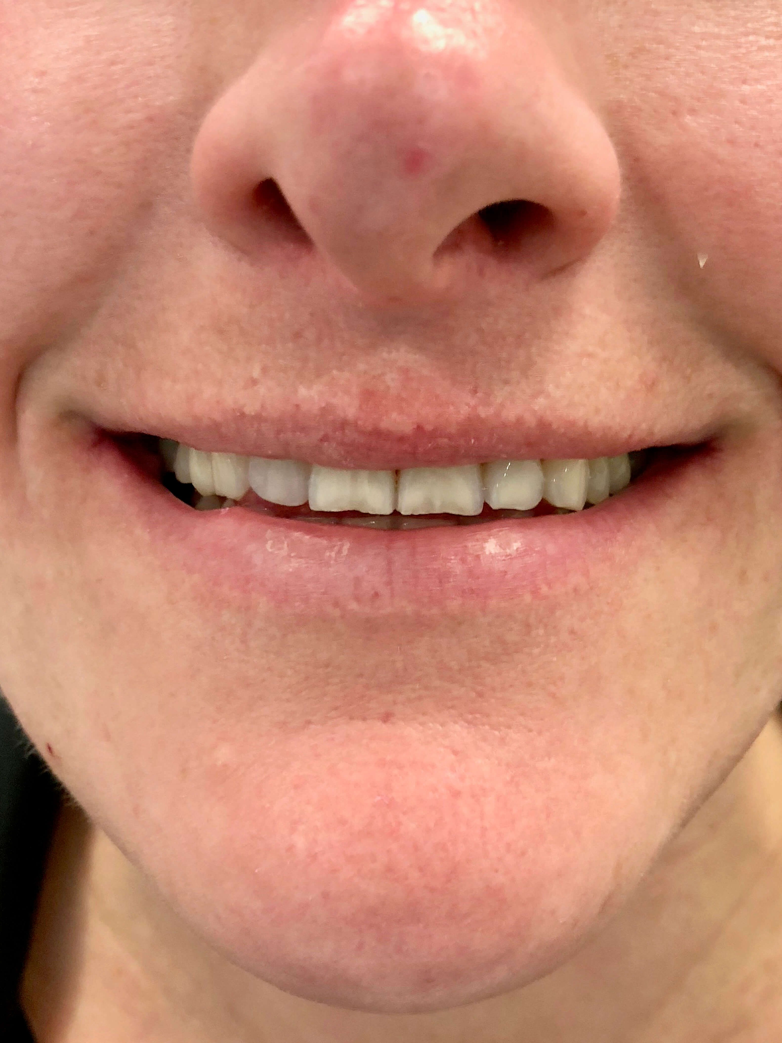 Reverse Years of Grinding Before