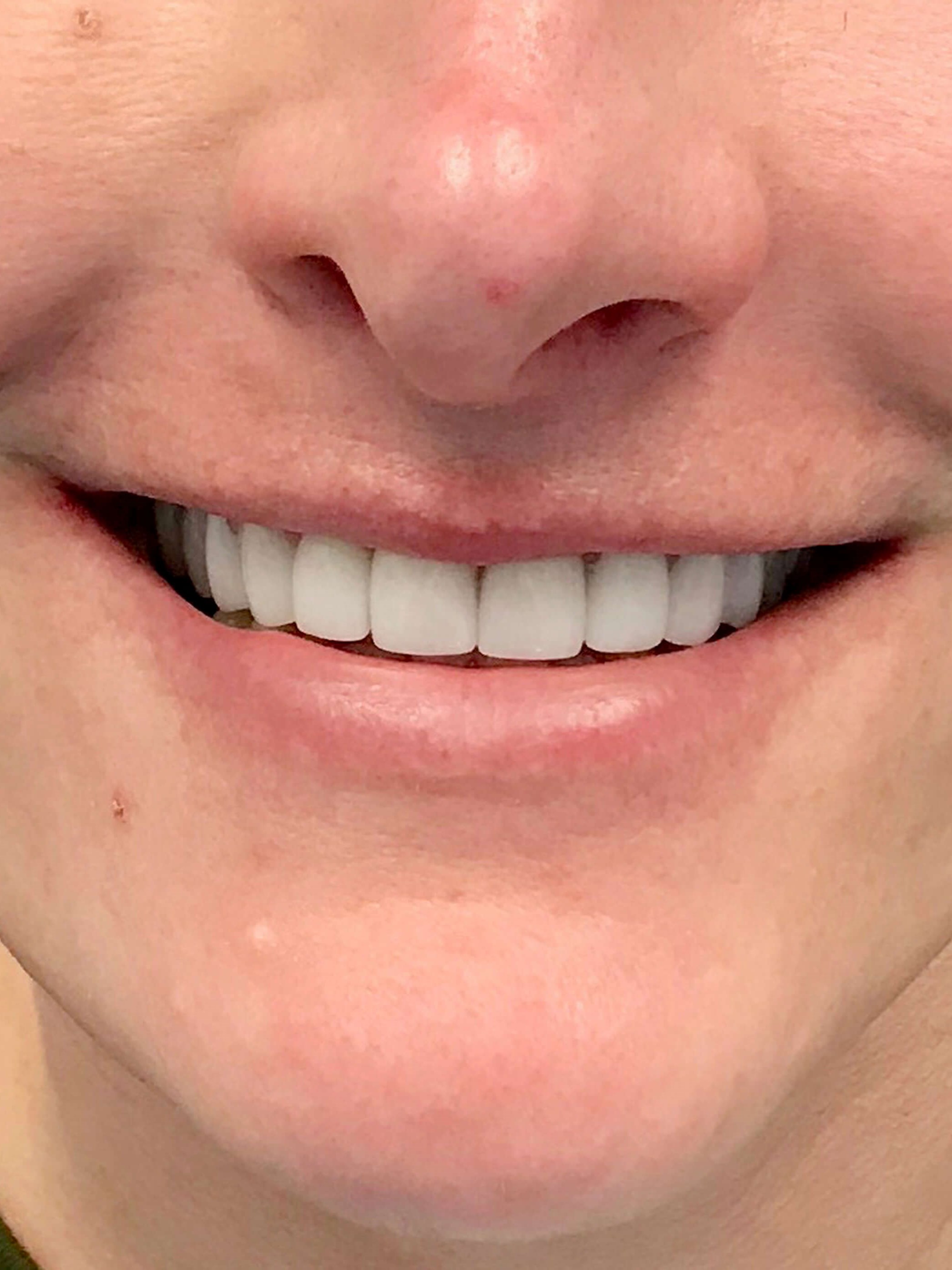 Reverse Years of Grinding After