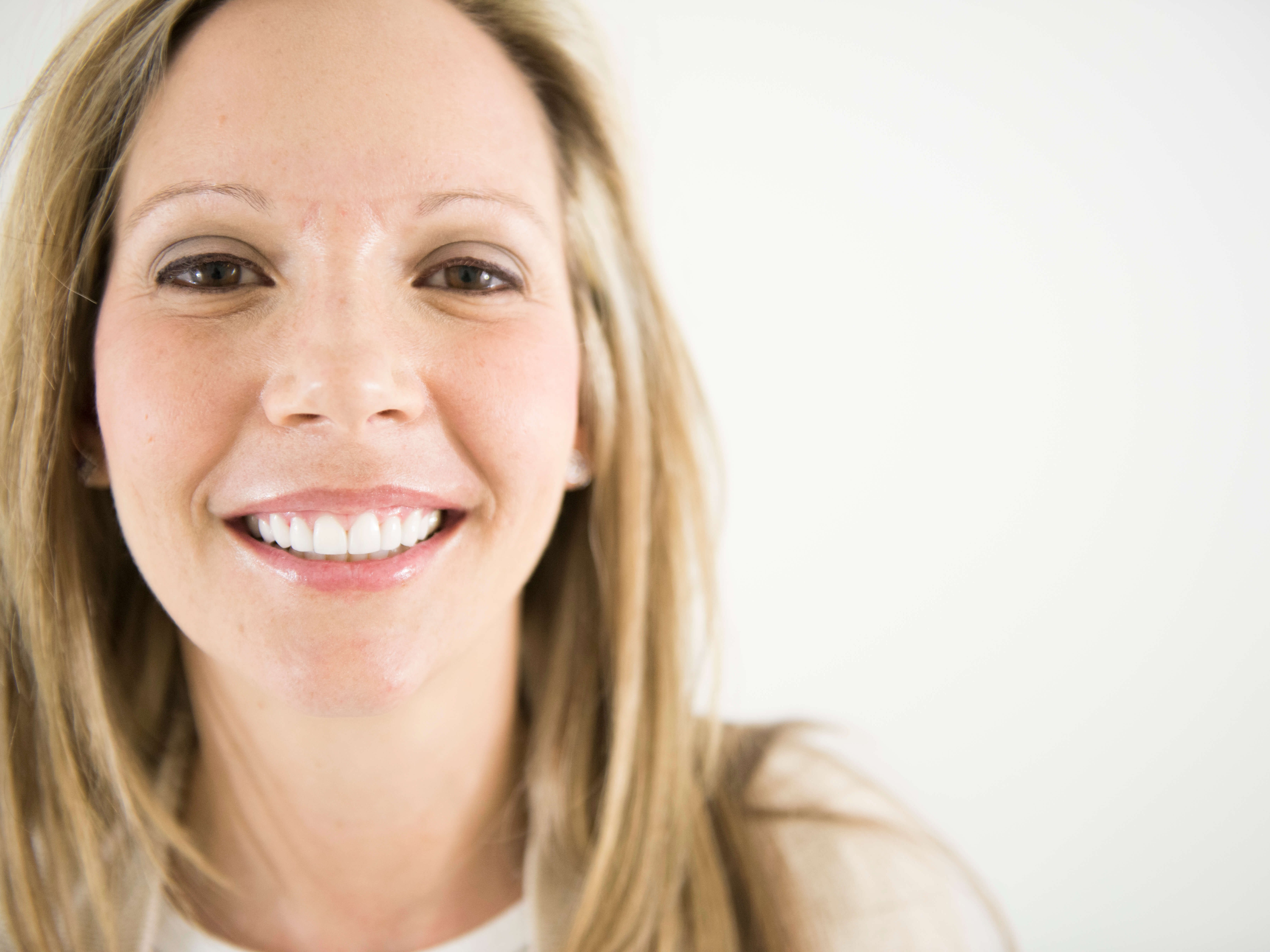 Porcelain Veneers After