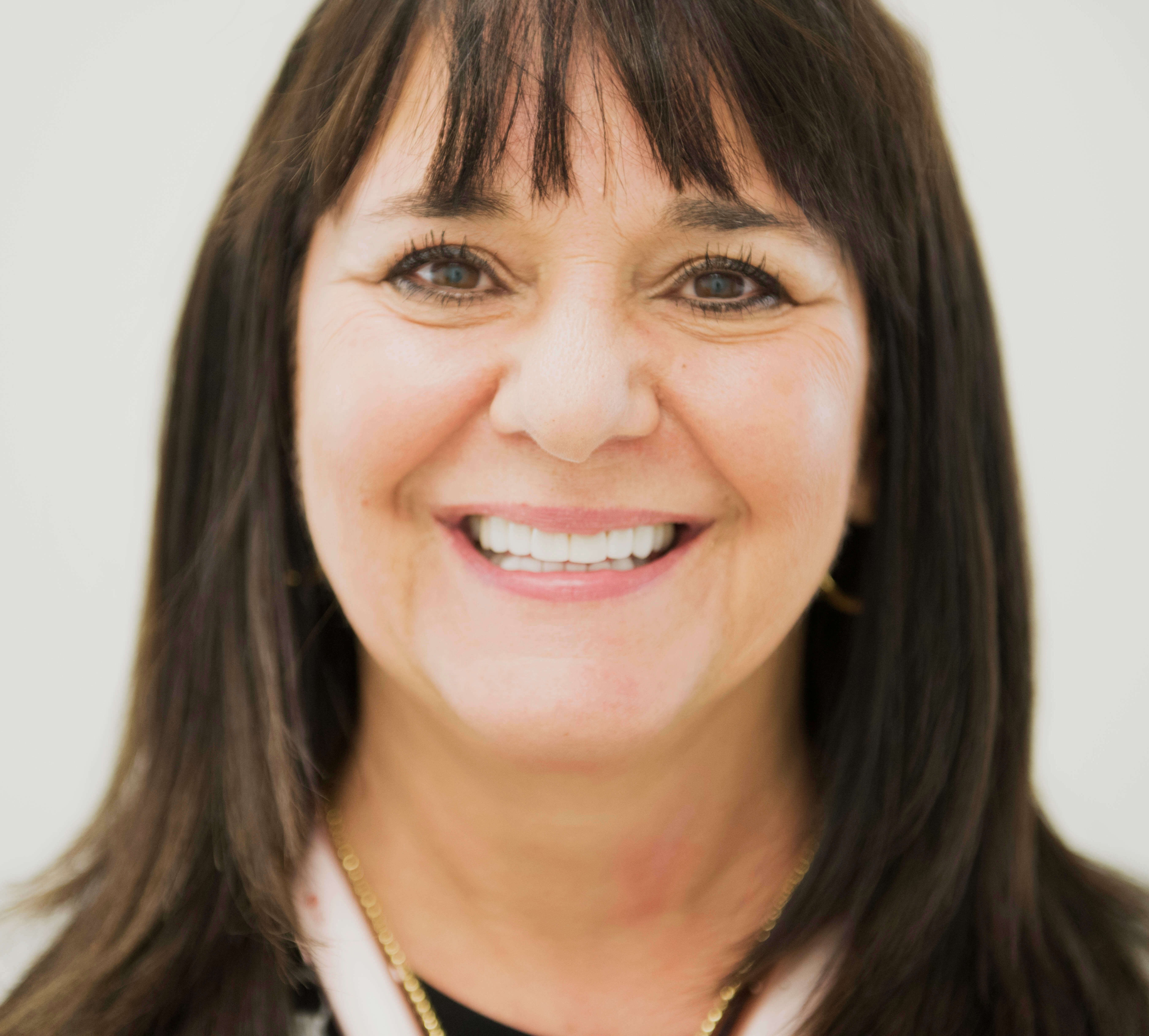 Porcelain Veneers After