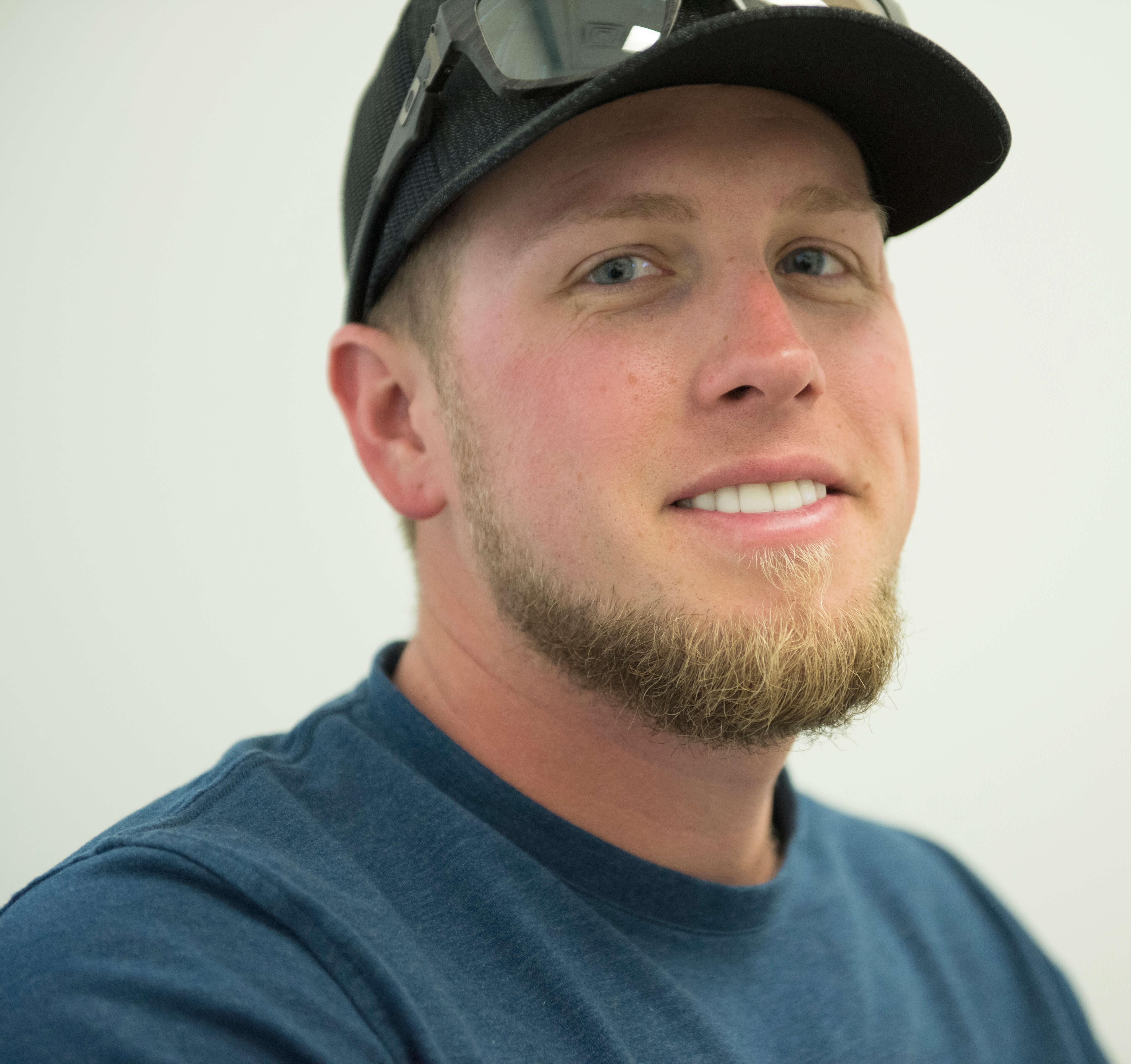 Smile makeover After