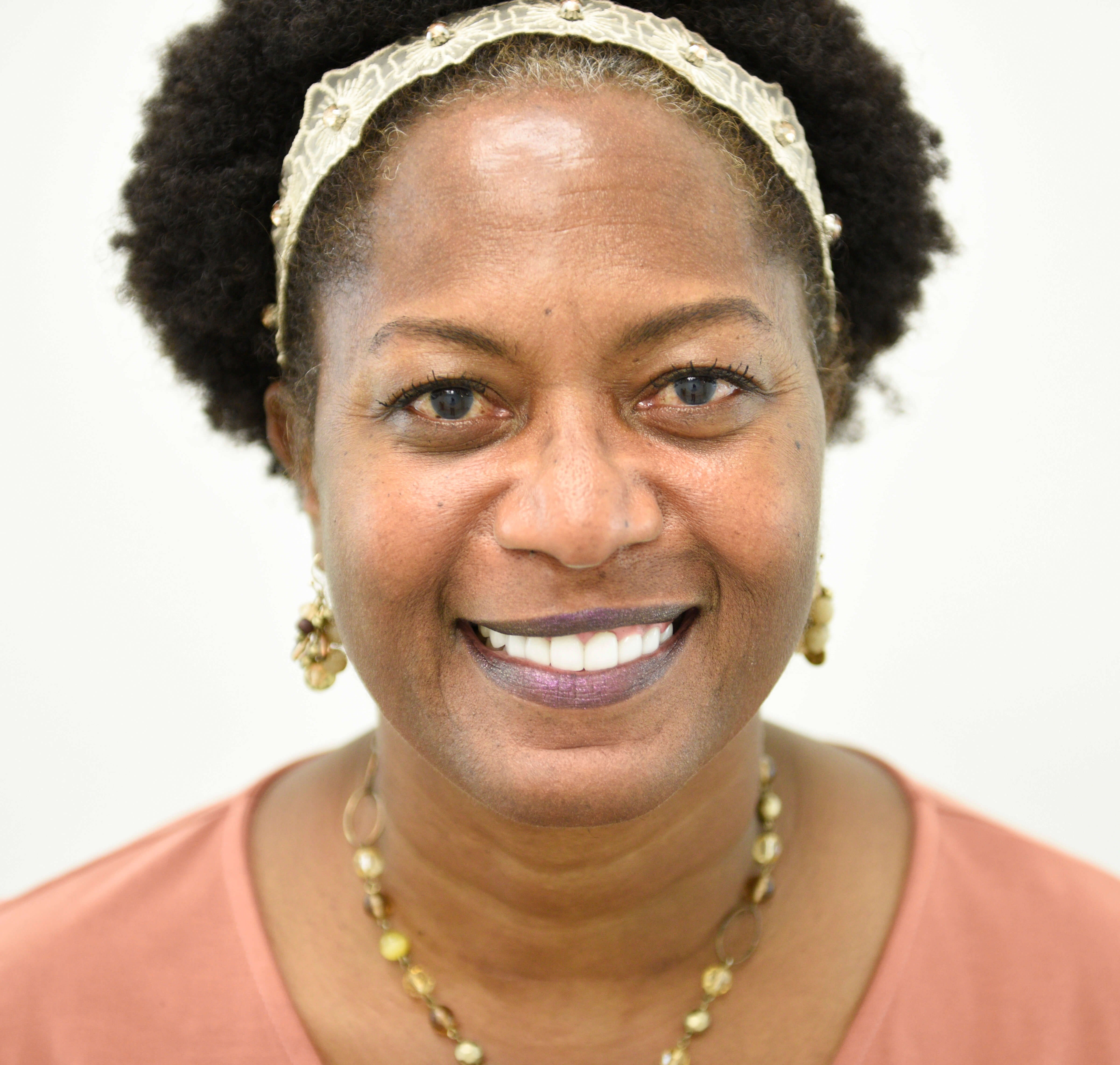 Smile Makeover After