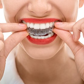 Invisalign®