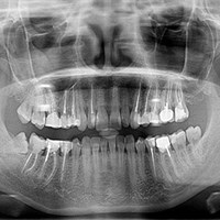 Digital X-Rays